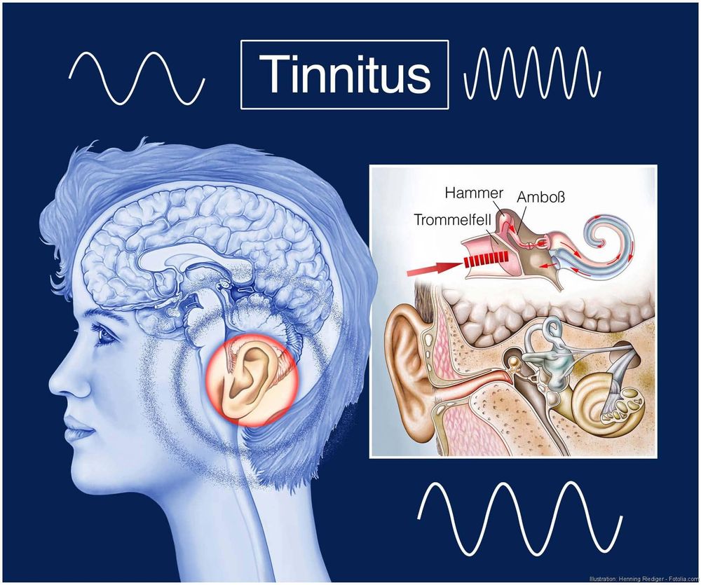 Tinnitus Management: Sound Therapy, Cognitive Behavioral Therapy, and Promising Research