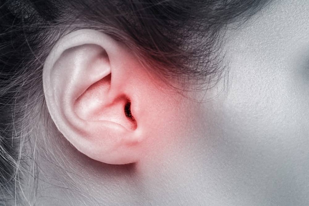 5 Tips to Manage Tinnitus Naturally